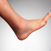 ​​Sudden onset of weakness of lower limbs​