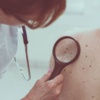 ​Changes in the skin​