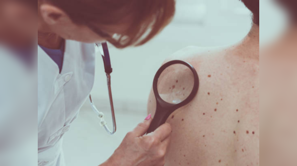 Changes in the skin