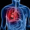 ​The telltale trio: Fever, cough, and shortness of breath​