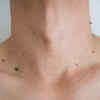 Neck Moles