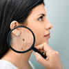What are moles?