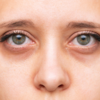 ​Skincare saviors: Ingredients for brighter days