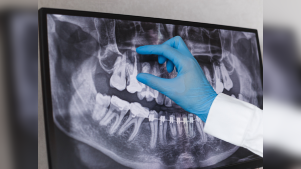 Regular dental check-ups