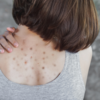 ​​Aha Bha and solutions for peeling​