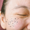 <strong>​Methods to address dark spots</strong>