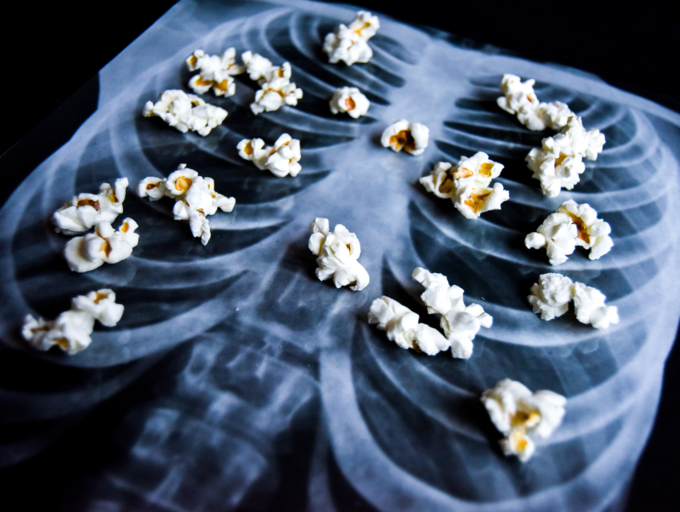 Popcorn Lung Signs and Symptoms What is Popcorn Lung? Signs and