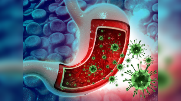 What is norovirus?