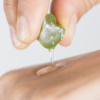 ​​Aloe Vera gel as a topical treatment​