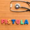 ​​Fistula​