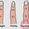 If you have a knuckled finger