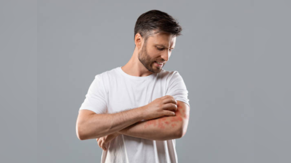 Check for nutritional deficiencies