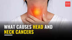 
What causes head and neck cancers, expert explains
