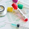 What happens when our body has increased uric acid?