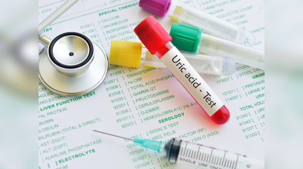 What happens when our body has increased uric acid?