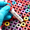 How to maintain uric acid level in body?