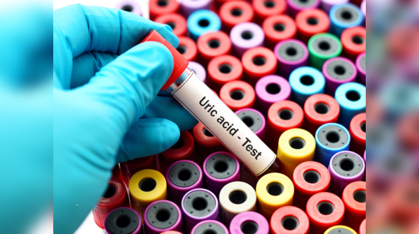 How to maintain uric acid level in body?