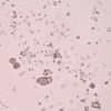 How does uric acid help our body?