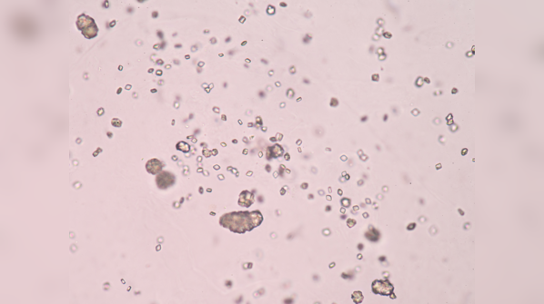 How does uric acid help our body?