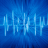 ​Abnormal heart rhythms