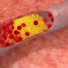Reduces cholesterol levels