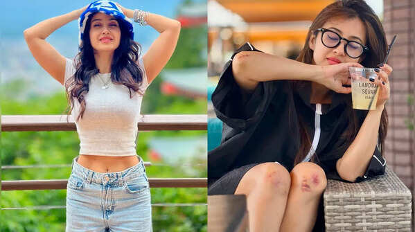 From adventure to accident! Monami Ghosh shares photos of her scars from her Japan trip