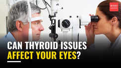 
Can thyroid issues affect your eyes?

