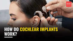
How do Cochlear implants work?
