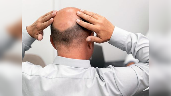 Hair oiling: The ultimate treatment?