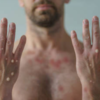 ​Monkeypox preventive measures​