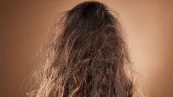 Dry and frizzy hair issues