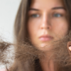 Article image for: <i class="tbold">hair loss</i>