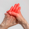 ​Strange sensations in hands and feet