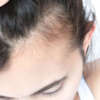 Cleans the scalp