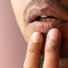 Extreme dehydration and its effect