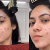 ​It was hard for her to accept that face