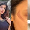​Samridhii reveals she got burnt on the sets of Savi Ki Savaari