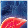 Article image for: <i class="tbold">fatty liver</i>