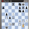 D Gukesh Vs Ding Liren Game 7 Chess Live Updates: Important moment in the game! 