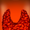Article image for: 9 foods to avoid with <i class="tbold">hypothyroidism</i>