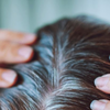Article image for: Dos and don'ts to bid goodbye to premature grey hair