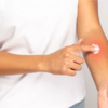 Start with a patch test