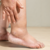 2. Swollen feet