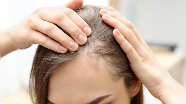 Hair thinning is often linked to iron deficiency