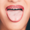 A constantly sore or swollen tongue