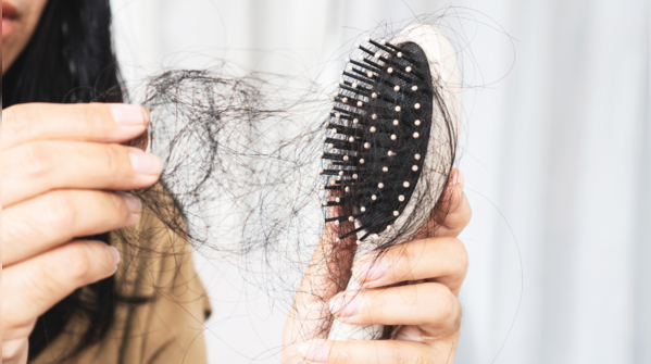 Hair falls in clumps, not just strands