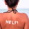 ​Pro tips for sunburn recovery
