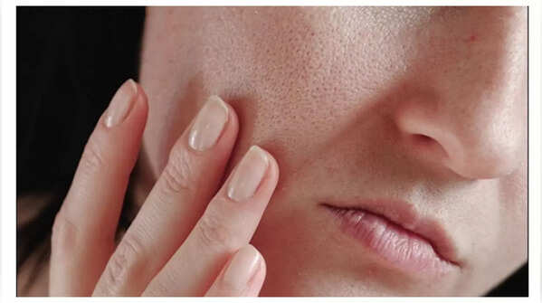 Dry skin