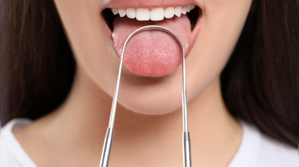 A tongue that looks bald