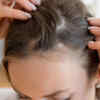 ​Traction alopecia